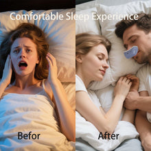 Anti-Snoring Nasal Breathing Device – Quiet, Rechargeable, Ergonomic Fit